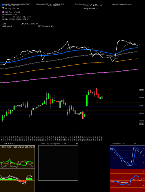 Tenet Healthcare Corporation THC Support Resistance charts Tenet Healthcare Corporation THC NYSE