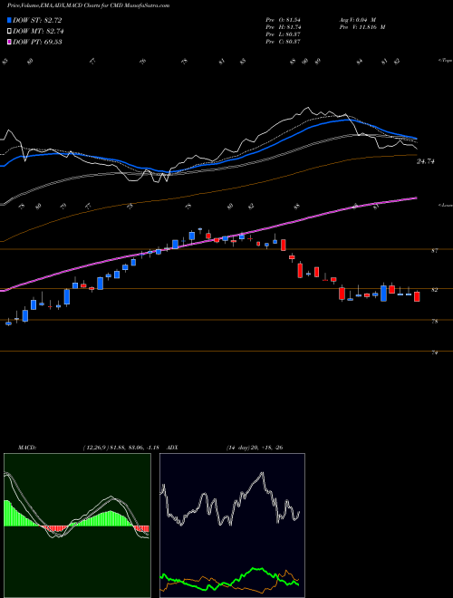 MACD charts various settings share CMD Cantel Medical Corp. NYSE Stock exchange 