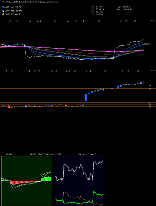 MACD charts various settings share HAE Haemonetics Corporation NYSE Stock exchange 