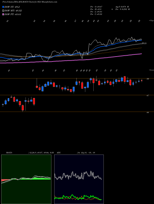 MACD charts various settings share HLS Healthsouth Corp NYSE Stock exchange 
