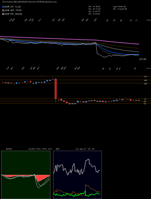 MACD charts various settings share ITGR Integer Holdings Corporation NYSE Stock exchange 
