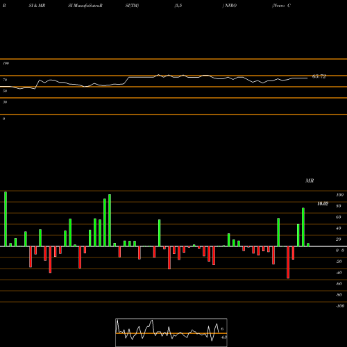 RSI & MRSI charts Nevro Corp. NVRO share NYSE Stock Exchange 