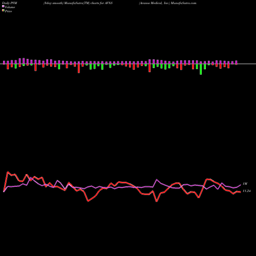 PVM Price Volume Measure charts Avanos Medical, Inc. AVNS share NYSE Stock Exchange 