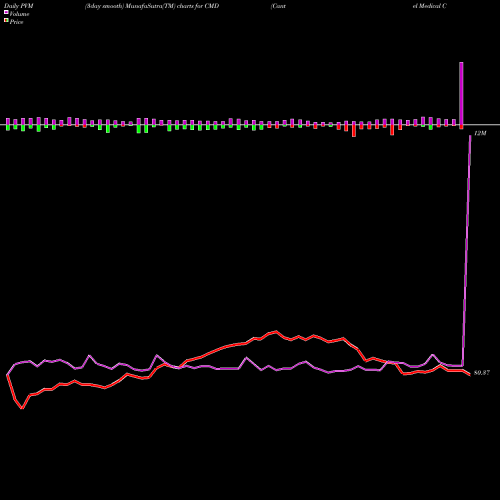 PVM Price Volume Measure charts Cantel Medical Corp. CMD share NYSE Stock Exchange 