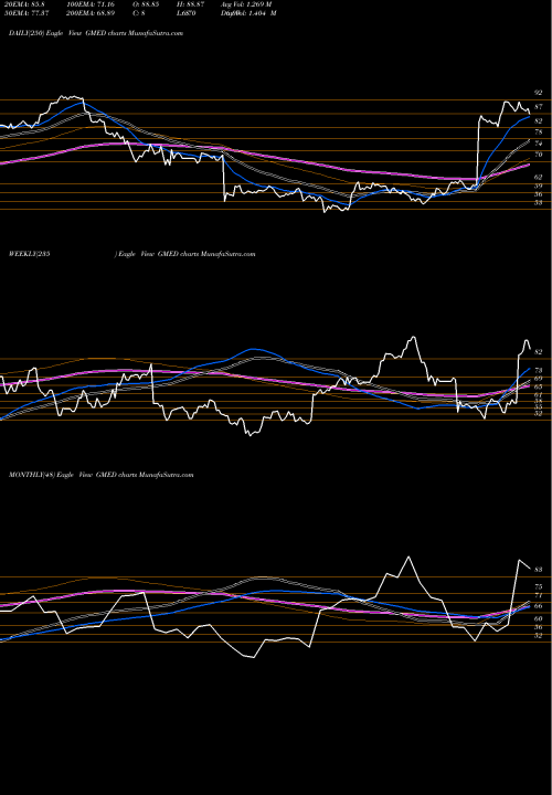 Trend of Globus Medical GMED TrendLines Globus Medical, Inc. GMED share NYSE Stock Exchange 
