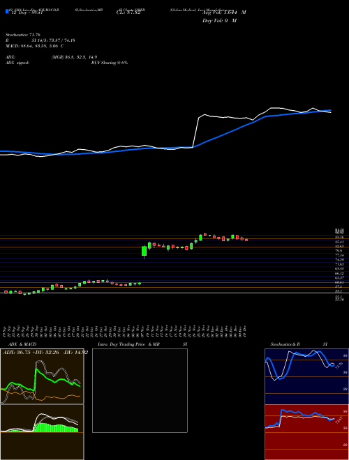 Chart Globus Medical (GMED)  Technical (Analysis) Reports Globus Medical [