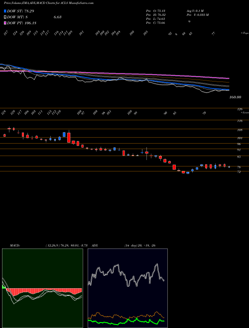 MACD charts various settings share ACLS Axcelis Technologies, Inc. USA Stock exchange 