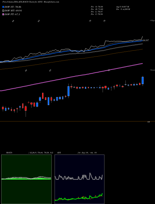 MACD charts various settings share AXNX Axonics Modulation Technologies, Inc. USA Stock exchange 