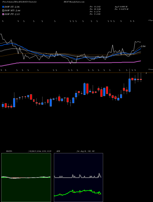 MACD charts various settings share BEAT BioTelemetry, Inc. USA Stock exchange 