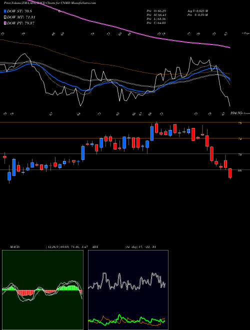 MACD charts various settings share CNMD CONMED Corporation USA Stock exchange 