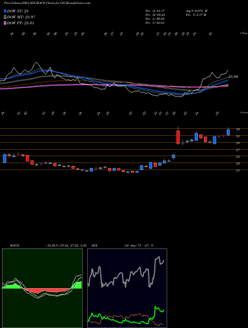 MACD charts various settings share GH Guardant Health, Inc. USA Stock exchange 