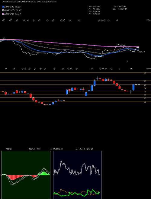 MACD charts various settings share IRTC IRhythm Technologies, Inc. USA Stock exchange 