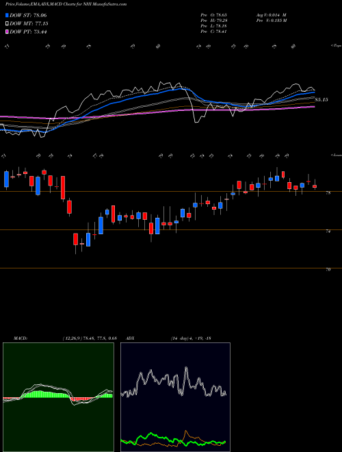 MACD charts various settings share NHI National Health Investors, Inc. USA Stock exchange 