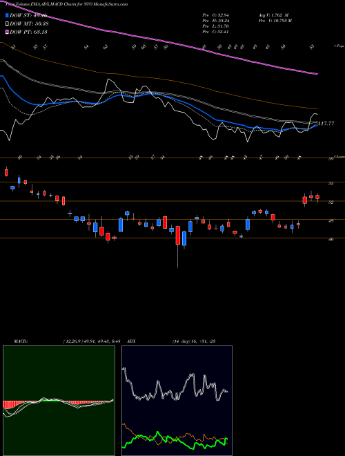 MACD charts various settings share NVO Novo Nordisk A/S USA Stock exchange 