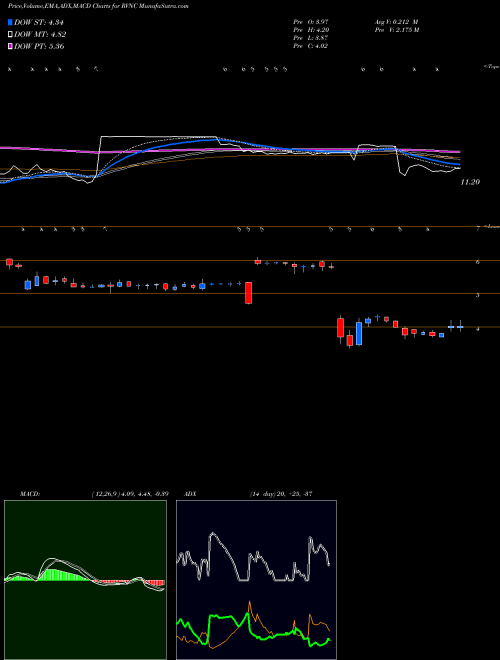 Munafa Revance Therapeutics, Inc. (RVNC) stock tips, volume analysis, indicator analysis [intraday, positional] for today and tomorrow