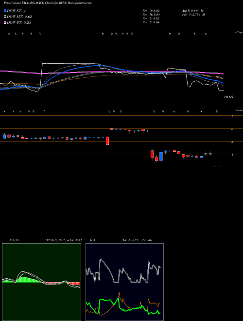 MACD charts various settings share RVNC Revance Therapeutics, Inc. USA Stock exchange 