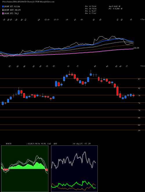 MACD charts various settings share TCBI Texas Capital Bancshares, Inc. USA Stock exchange 