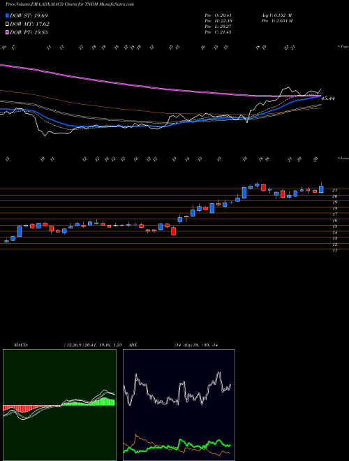 MACD charts various settings share TNDM Tandem Diabetes Care, Inc. USA Stock exchange 