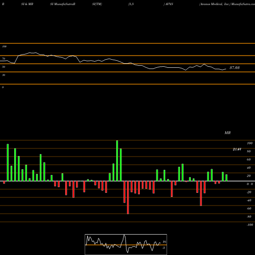 RSI & MRSI charts Avanos Medical, Inc. AVNS share USA Stock Exchange 