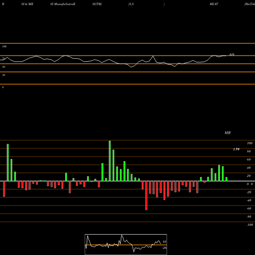 RSI & MRSI charts BioTelemetry, Inc. BEAT share USA Stock Exchange 