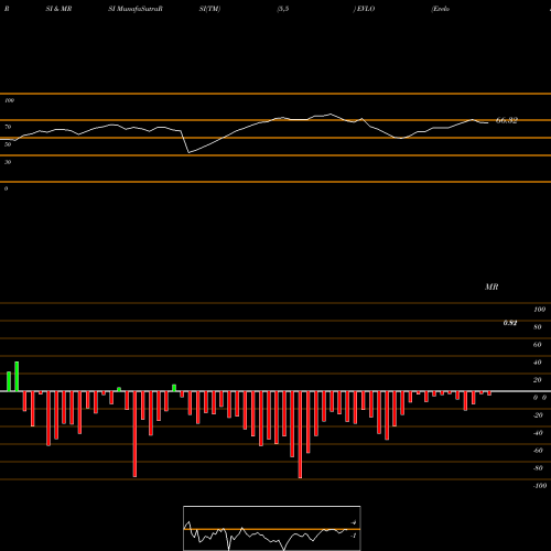 RSI & MRSI charts Evelo Biosciences, Inc. EVLO share USA Stock Exchange 