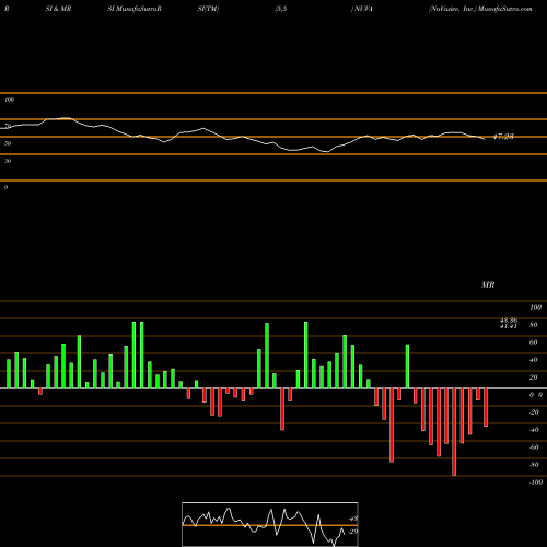 RSI & MRSI charts NuVasive, Inc. NUVA share USA Stock Exchange 
