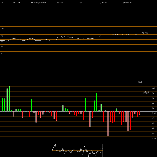 RSI & MRSI charts Nevro Corp. NVRO share USA Stock Exchange 