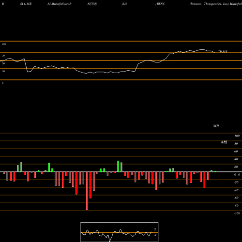 RSI & MRSI charts Revance Therapeutics, Inc. RVNC share USA Stock Exchange 
