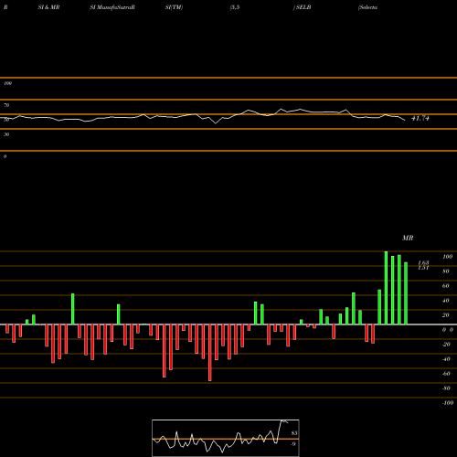 RSI & MRSI charts Selecta Biosciences, Inc. SELB share USA Stock Exchange 