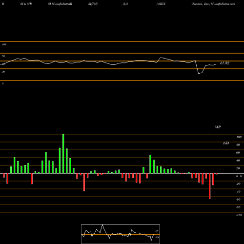 RSI & MRSI charts Sientra, Inc. SIEN share USA Stock Exchange 