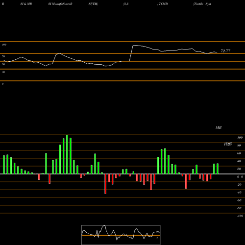 RSI & MRSI charts Tactile Systems Technology, Inc. TCMD share USA Stock Exchange 