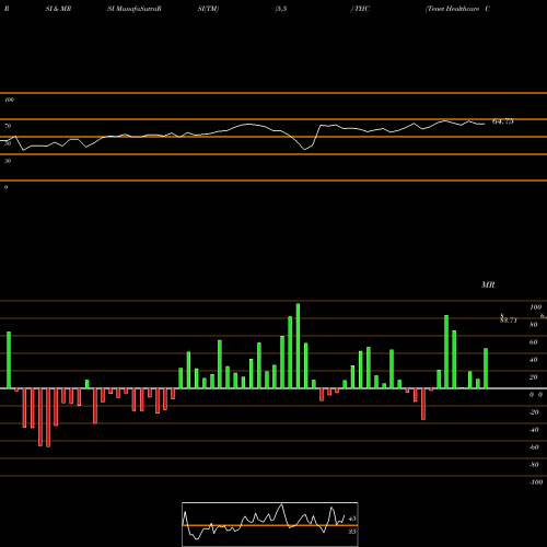 RSI & MRSI charts Tenet Healthcare Corporation THC share USA Stock Exchange 