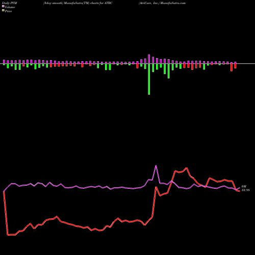 PVM Price Volume Measure charts AtriCure, Inc. ATRC share USA Stock Exchange 