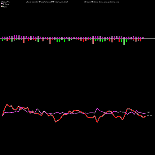 PVM Price Volume Measure charts Avanos Medical, Inc. AVNS share USA Stock Exchange 