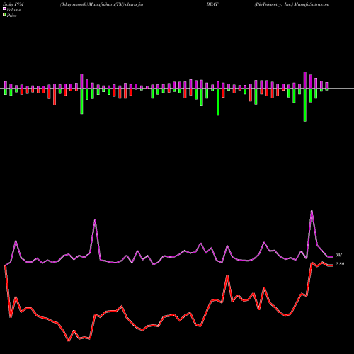 PVM Price Volume Measure charts BioTelemetry, Inc. BEAT share USA Stock Exchange 