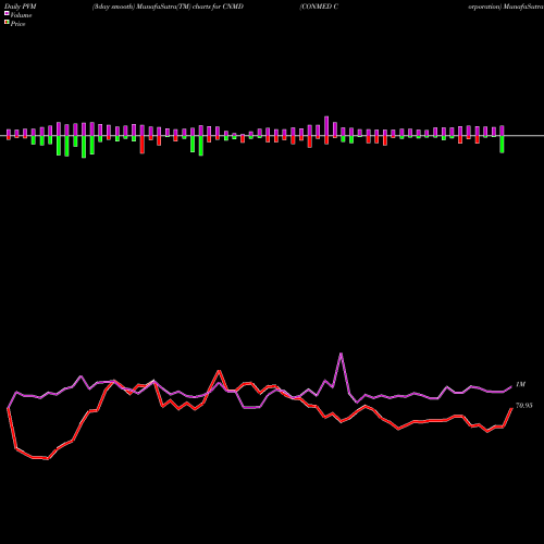 PVM Price Volume Measure charts CONMED Corporation CNMD share USA Stock Exchange 