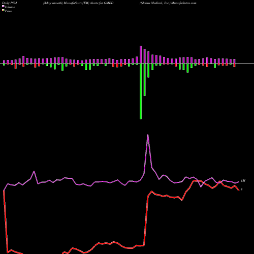 PVM Price Volume Measure charts Globus Medical, Inc. GMED share USA Stock Exchange 
