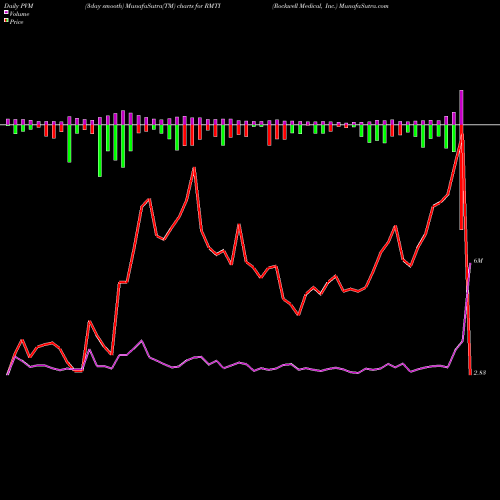 PVM Price Volume Measure charts Rockwell Medical, Inc. RMTI share USA Stock Exchange 