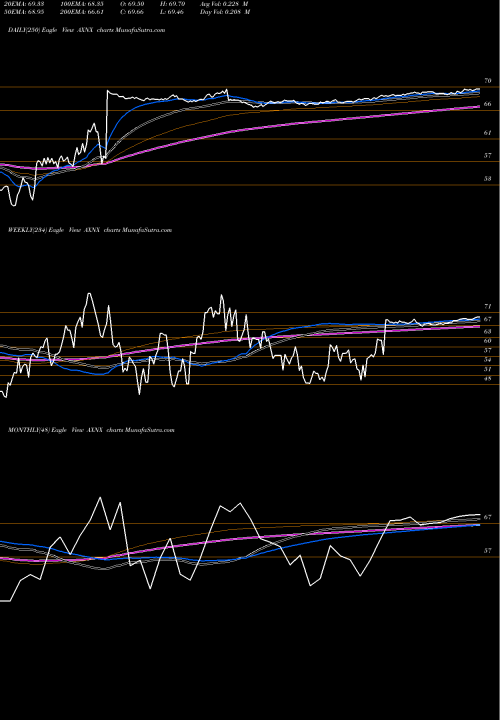 Trend of Axonics Modulation AXNX TrendLines Axonics Modulation Technologies, Inc. AXNX share USA Stock Exchange 