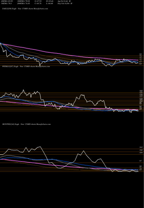 Trend of Conmed Corporation CNMD TrendLines CONMED Corporation CNMD share USA Stock Exchange 