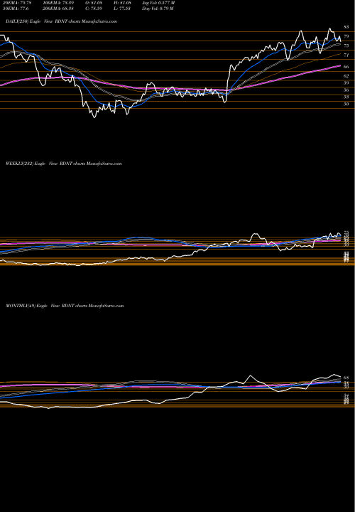 Trend of Radnet Inc RDNT TrendLines RadNet, Inc. RDNT share USA Stock Exchange 