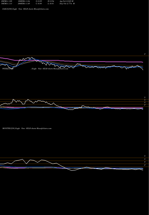 Trend of Selecta Biosciences SELB TrendLines Selecta Biosciences, Inc. SELB share USA Stock Exchange 
