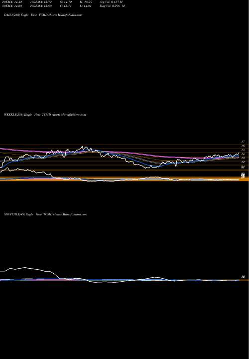 Trend of Tactile Systems TCMD TrendLines Tactile Systems Technology, Inc. TCMD share USA Stock Exchange 