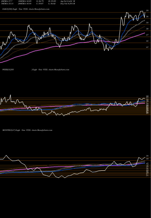 Trend of Vericel Corporation VCEL TrendLines Vericel Corporation VCEL share USA Stock Exchange 