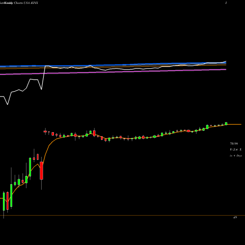 Weekly charts share AXNX Axonics Modulation Technologies, Inc. USA Stock exchange 