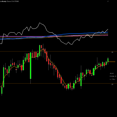 Weekly charts share TCMD Tactile Systems Technology, Inc. USA Stock exchange 